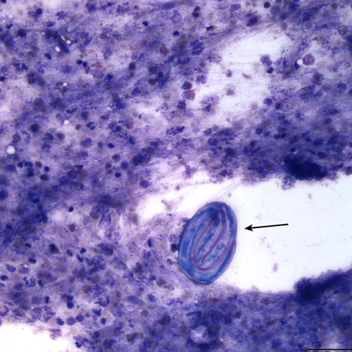 Spermidine Trihydrochloride | Shaanxi BLOOM Tech Co., Ltd Spermidine Trihydrochloride | Shaanxi BLOOM Tech Co., Ltd